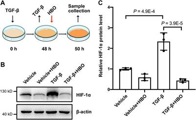 Hyperbaric Oxygen Ameliorates Bleomycin-Induced Pulmonary Fibrosis in Mice